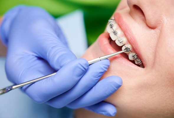 Close,Up,Of,Dentist,Hand,Using,Dental,Forceps,While,Putting